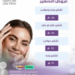 عروض التشقير