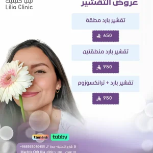 عروض التقشير