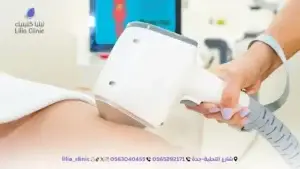 4 نصائح يجب اتباعها قبل وبعد جلسة إزالة الشعر بالليزر في جدة