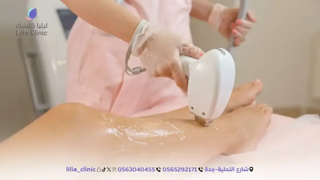 5 مميزات لجلسات ليزر الجسم الكامل في ليليا كلينك