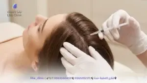 أفضل 4 فوائد لجلسات الميزوثيرابي لإنبات وتكثيف الشعر في جدة