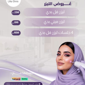 عروض الليزر